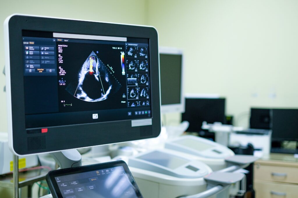 echocardiogram machine